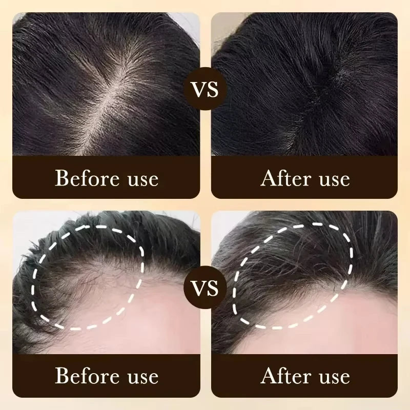 Sérum de repousse des cheveux – Fortifie les cheveux, nourrit le cuir chevelu, améliore la circulation, formule légère non grasse